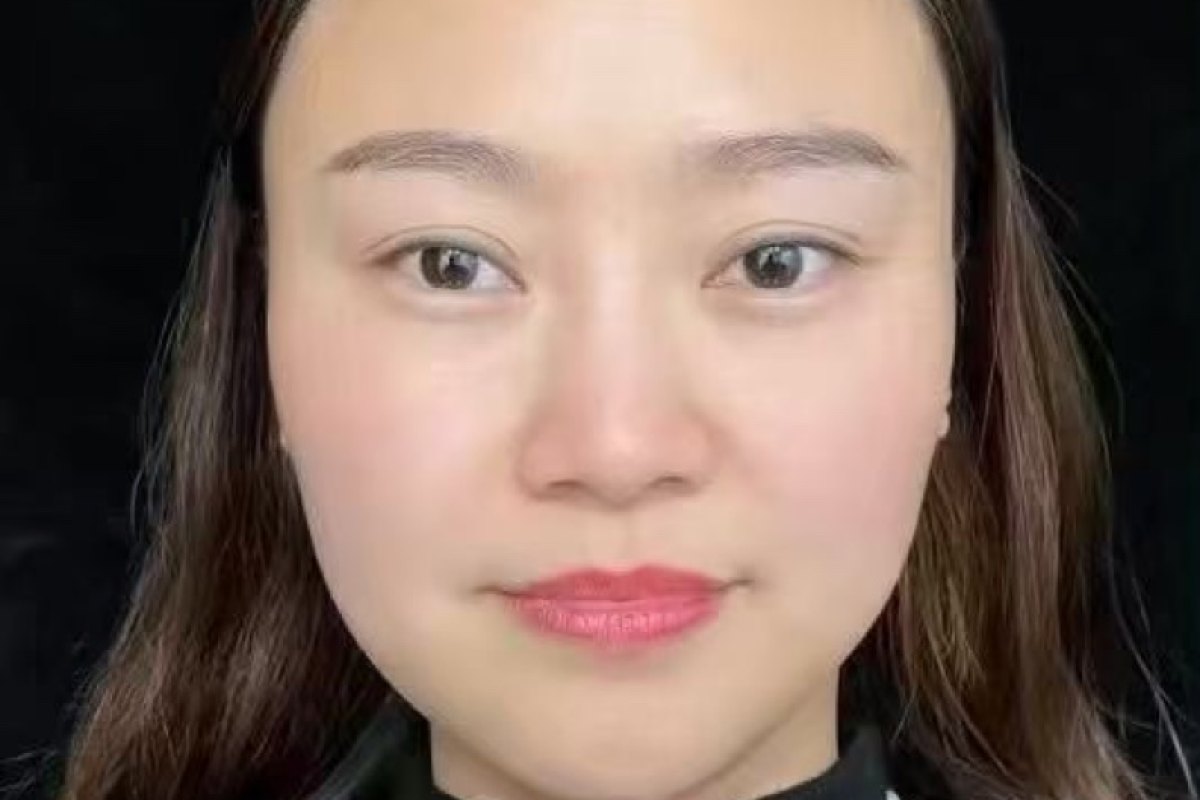 Before — Full face · after treatment
