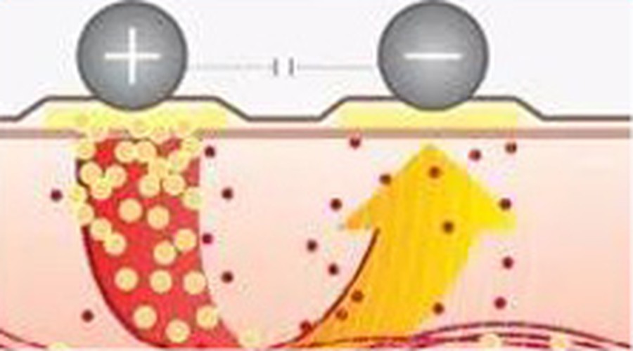 Closed-loop conduction