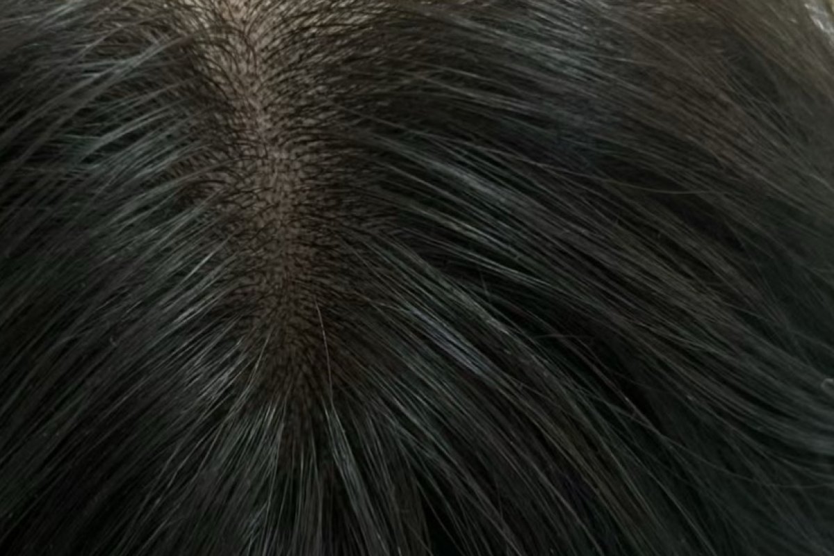 After — Hairline & part · after the full course