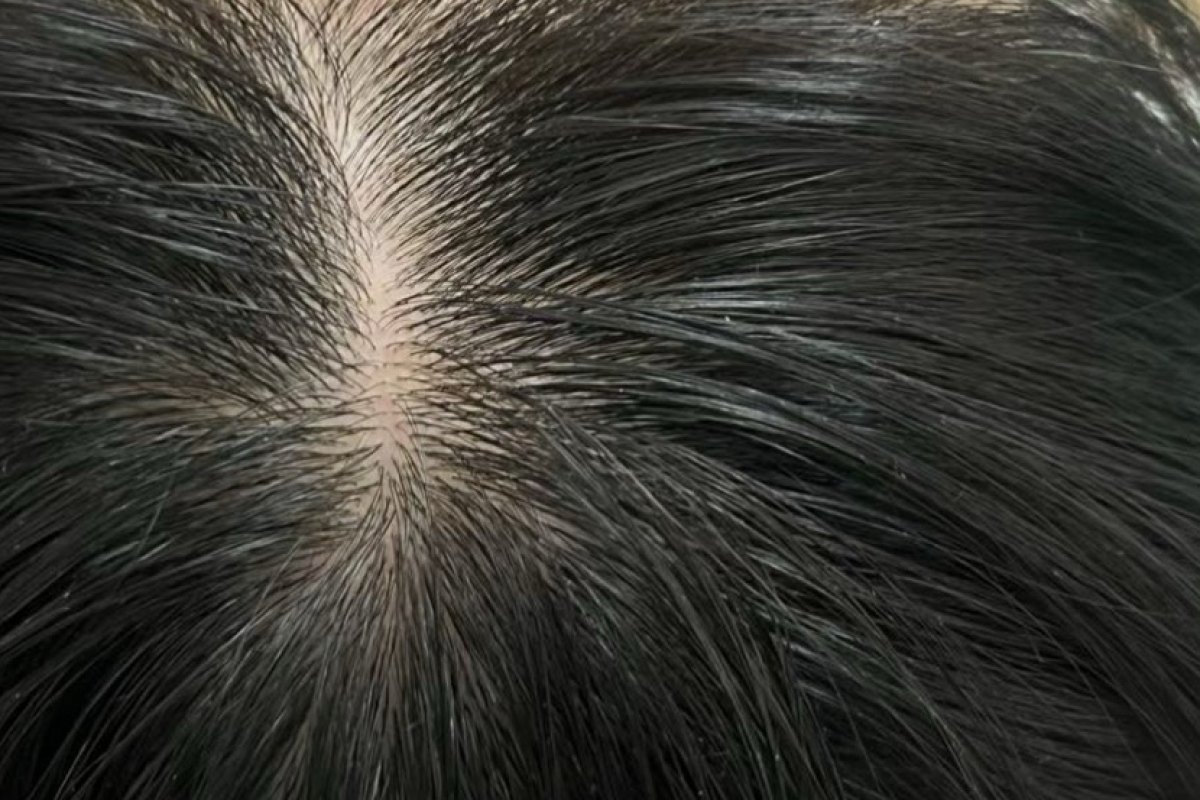 Before — Hairline & part · after the full course