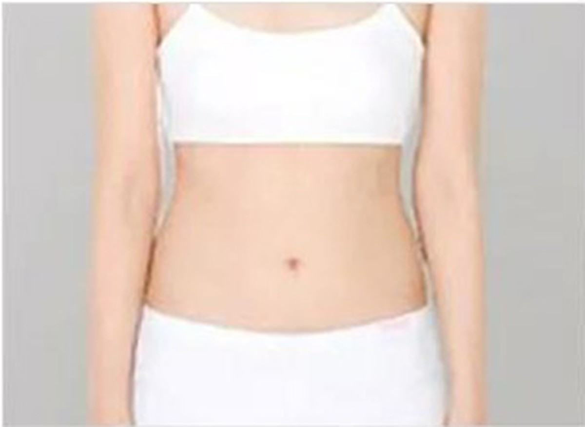 After — Abdomen